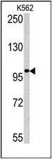 Western blot analysis of MAGEC1 antibody (C-term) in K562 cell line lysates (35ug/lane). MAGEC1 (arrow) was detected using the purified Pab.