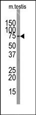 Western blot analysis of anti-SOX30 Antibody (Center) in mouse testis tissue lysates (35ug/lane). SOX30 (arrow) was detected using the purified Pab (1:60 dilution).