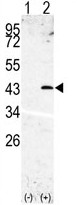 Western blot analysis of SPPL3 (arrow) using rabbit polyclonal SPPL3 Antibody (N-term). 293 cell lysates (2 ug/lane) either nontransfected (Lane 1) or transiently transfected with the SPPL3 gene (Lane 2)
