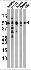 The anti-Drosophila Parkin Pab is used in Western blot to detect Drosophila Parkin in, from left to right, mouse kidney, mouse brain, mouse heart, Ramos, and Hela tissue lysates.