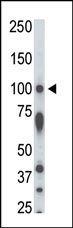 The anti-STK31 Pab is used in Western blot to detect STK31 in rat testis tissue lysate.