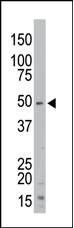 The anti-STK35 Pab is used in Western blot to detect STK35 in mouse kidney tissue lysate.