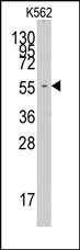 Western blot analysis of anti-FARSA Pab in K562 cell line lysates (35ug/lane).FARSA (arrow) was detected using the purified Pab (1:60 dilution).