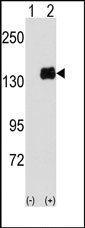 Western blot analysis of PUM1 (arrow) using PUM1 Antibody. 293 cell lysates (2 ug/lane) either nontransfected (Lane 1) or transiently transfected with the PUM1 gene (Lane 2)