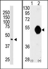 (LEFT)Western blot analysis of anti-DOK2 Pab in 174xCEM cell lysate. DOK2 (Arrow) was detected using purified Pab. Secondary HRP-anti-rabbit was used for signal visualization with chemiluminescence. (RIGHT)Western blot analysis of DOK2 (arrow) using DOK2 Antibody (C-term). 293 cell lysates (2 ug/lane) either nontransfected (Lane 1) or transiently transfected with the DOK2 gene (Lane 2).