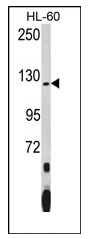 Figure 1. Western blot analysis of PUM1 antibody (Human, N-term) in HL-60 cell line lysates (35 ug/lane). PUM1 (arrow) was detected using the purified Pab (2 ug/ml)