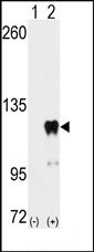 Figure 1. Western blot analysis of PUM2 (arrow) using PUM2 Antibody. 293 cell lysates (2 ug/lane) either non-transfected (Lane 1) or transiently transfected with the PUM2 gene (Lane 2) (Origene Technologies).