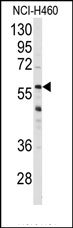 Immunoreactivity of this antibody on protein extract from rat (Lane 1) and mouse brain (Lane 2). GLT1 protein is detected at 35 kDa and 70 kDa as dimmer In lane 3, inhibition of the immunoreactivity of the Ab with blocking peptide (1/1000 dilution)