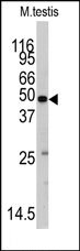 Western blot analysis of anti-MARS2 Antibody (C-term) in Mouse testis tissue lysates (35ug/lane). MARS2 (arrow) was detected using the purified Pab (1:60 dilution).