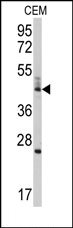 Western blot analysis of anti-BCL2L13 Antibody (Center) in CEM cell line lysates (35ug/lane). BCL2L13 (arrow) was detected using the purified Pab.