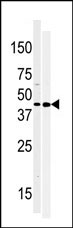 Western blot analysis of anti-MOS-R8 Pab in 293 (right) and Hela (right) cell line lysate (35ug/lane). MOS-R8 (arrow) was detected using the purified Pab (1:60 dilution).