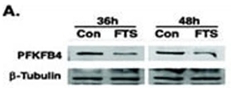 FTS down-regulates HIF-1 and HIF-1-regulated proteins in GBM cells. GBM cell lines were incubated under hypoxia (1% O2) for the indicated periods with FTS and then processed for the determination of PFKFB4 by Western Blot. Samples of total cell lysates were also immunoblotted with anti-Beta-Tubulin antibody.