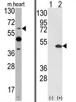 (LEFT) Western blot analysis of ETV4 antibody (C-term) in mouse heart tissue lysates (35 ug/lane). ETV4 (arrow) was detected using the purified Pab. (RIGHT) Western blot analysis of ETV4 (arrow) using ETV4 Antibody (C-term). 293 cell lysates (2 ug/lane) either nontransfected (Lane 1) or transiently transfected with the ETV4 gene (Lane 2).