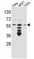Western Blot using Immunopurifed VGLUT1 antibody