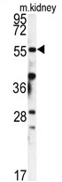 Western Blot analysis using VGLUT2 antibody Cat.-No AP55381PU-N. Cell lysate from Rat.