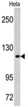 Western blot analysis of MAML3 antibody (C-term) in Hela cell line lysates (35ug/lane). MAML3 (arrow) was detected using the purified Pab.
