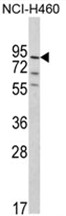 Western blot analysis of MyoGEF Antibody (N-term) in NCI-H460 cell line lysates (35ug/lane). MyoGEF (arrow) was detected using the purified Pab.