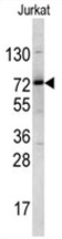Western blot analysis of NKRF antibody (Center) in Jurkat cell line lysates (35ug/lane). NKRF (arrow) was detected using the purified Pab.
