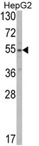 Western blot analysis of SLC38A3 Antibody (Center) in HepG2 cell line lysates (35ug/lane). SLC38A3 (arrow) was detected using the purified Pab.