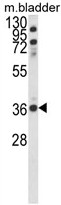 Western blot analysis of CCDC3 Antibody (C-term) in mouse bladder tissue lysates (35ug/lane). CCDC3 (arrow) was detected using the purified Pab.