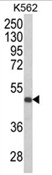 Western blot analysis of KIR3DS1 Antibody (C-term) (AP18085PU-N) in K562 cell line lysates (35ug/lane). KIR3DS1 (arrow) was detected using the purified Pab.