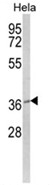 Western blot analysis of MOSC2 Antibody (C-term) in Hela cell line lysates (35ug/lane). MOSC2 (arrow) was detected using the purified Pab.