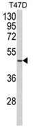 Western blot analysis of NCF1C Antibody (C-term) in T47D cell line lysates (35ug/lane). NCF1C (arrow) was detected using the purified Pab.