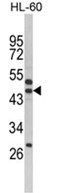 Western blot analysis of SERPINB7 Antibody (Center) in HL-60 cell line lysates (35ug/lane). SERPINB7 (arrow) was detected using the purified Pab.