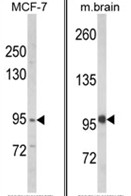 (LEFT) Western blot analysis of VPS53 Antibody (N-term) in MCF-7 cell line lysates (35ug/lane). VPS53 (arrow) was detected using the purified Pab. (RIGHT) Western blot analysis of VPS53 Antibody (N-term) in mouse brain tissue lysates (35ug/lane). VPS53 (arrow) was detected using the purified Pab.