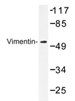 Western blot analyzes of Vimentin antibody (Cat.-No.: AP20321PU-N) in extracts from A549 cells.
