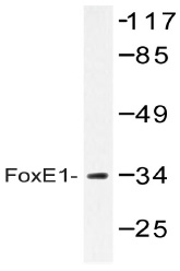 Western blot (WB) analysis of FoxE1 antibody (Cat.-No.: AP20398PU-N) in extracts from HUVEC cells.