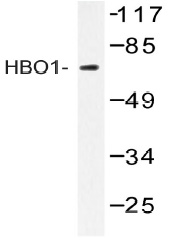 Western blot (WB) analysis of HBO1 antibody (Cat.-No.: AP20402PU-N) in extracts from Jurkat cells.