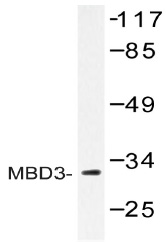 Western blot (WB) analysis of MBD3 antibody (Cat.-No.: AP20404PU-N) in extracts from Jurkat cells.
