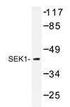 Western blot analysis of SEK1 antibody (Cat.-No.: AP20418PU-N) in extracts from 293 cells.
