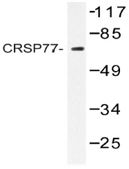 Western blot (WB) analysis of CRSP77 antibody (Cat.-No.: AP20462PU-N) in extracts from HT-29 cells.