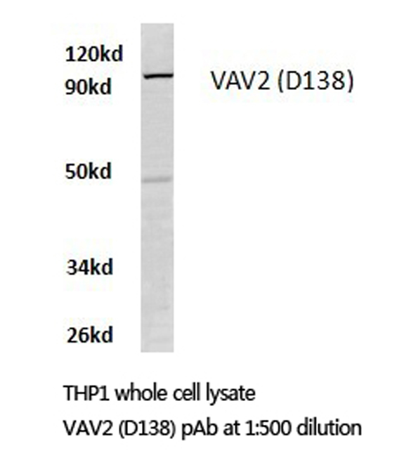 Western blot (WB) analysis of VAV2 antibody (Cat.-No.: AP20506PU-N) in extracts from THP1 cells.