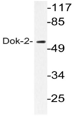 Western blot (WB) analyzes of Dok-2 antibody in extracts from COLO205 cells.
