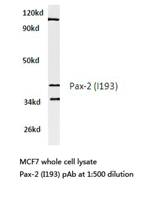HEK293T cells were transfected with the pCMV6-ENTRY control (Left lane) or pCMV6-ENTRY tdTomato (Right lane) cDNA for 48 hrs and lysed. Equivalent amounts of cell lysates (5ug per lane) were separated by SDS-PAGE and immunoblotted with anti-tdTomato (TA180009, 1:2000).
