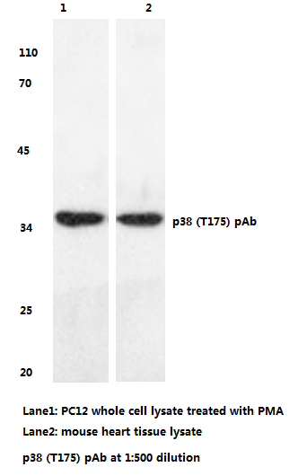 HEK293T cells were transfected with the pCMV6-ENTRY control (Left lane) or pCMV6-ENTRY mStrawberry (Right lane) cDNA for 48 hrs and lysed. Equivalent amounts of cell lysates (5ug per lane) were separated by SDS-PAGE and immunoblotted with anti-mStrawberry (TA180039, 1:2000).
