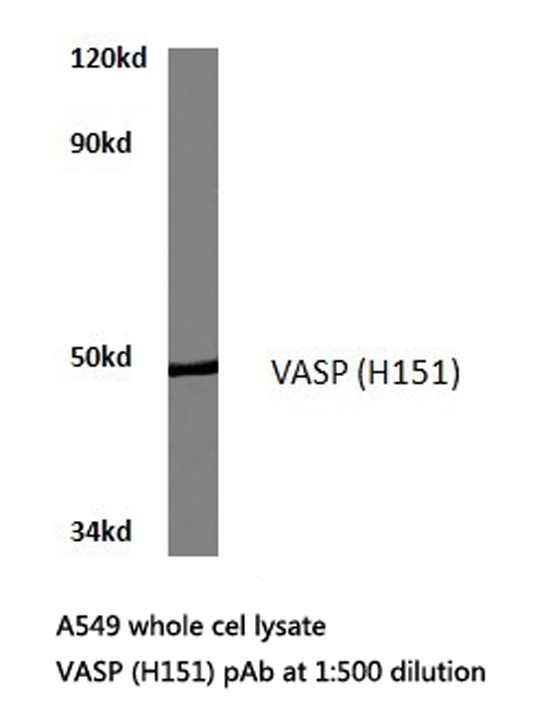 HEK293T cells were transfected with the pCMV6-ENTRY control (Left lane) or pCMV6-ENTRY Dendra2 (Right lane) cDNA for 48 hrs and lysed. Equivalent amounts of cell lysates (5ug per lane) were separated by SDS-PAGE and immunoblotted with anti-Dendra2 (TA180094, 1:500).