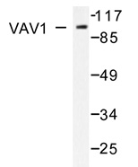 HEK293T cells were transfected with the pCMV6-ENTRY control (Left lane) or HA tagged LGALS3 cDNA for 48 hrs and lysed. Equivalent amounts of cell lysates (5ug per lane) were separated by SDS-PAGE and immunoblotted with anti-HA.