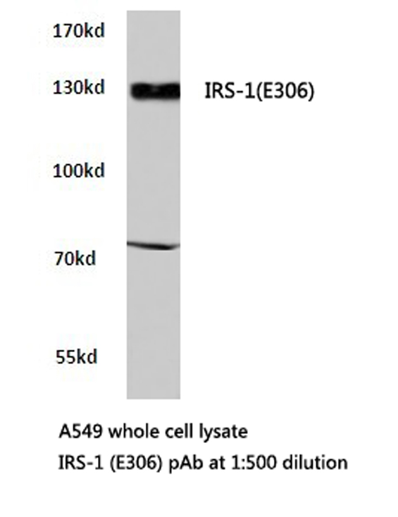 HEK293T cells were transfected with the pCMV6-ENTRY control (Left lane) or pCMV6-ENTRY tdTomato (JB1016_D07, Right lane) cDNA for 48 hrs and lysed. Equivalent amounts of cell lysates (5ug per lane) were separated by SDS-PAGE and immunoblotted with anti-tdTomato (1:500).