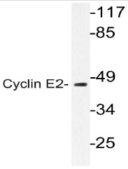 Western blot (WB) analysis of Cyclin E2 antibody (Cat.-No.: AP20796PU-N) in extracts from Jurkat cell.