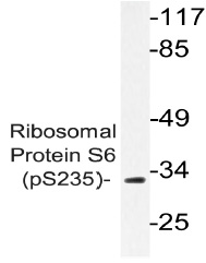 VEGF-C Sandwich-ELISA using the polyclonal anti-rat VEGF-C antibody as capture antibody and recombinant Rat VEGF-C ( DA3519X) as standard. The Biotinylated rabbit anti-rat VEGF-C (No B) was used as detection antibody.