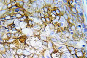 GABA A Receptor alpha 4 (dilution: 2.5ug/ml) staining of paraffin embedded Human Cortex. Steamed antigen retrieval with citrate buffer pH 6, AP-staining.
