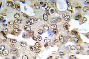 TH Staining in the Substantia Nigra.