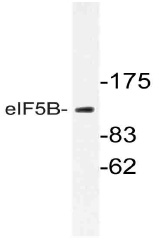 Western blot (WB) analysis of eIF5B antibody (Cat.-No.: AP21063PU-N) in extracts from Jurkat cells.