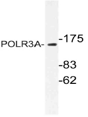Western blot (WB) analysis of POLR3A antibody (Cat.-No.: AP21068PU-N) in extracts from HUVEC cells.