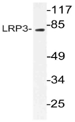 Western blot (WB) analysis of LRP3 antibody (Cat.-No.: AP21071PU-N) in extracts from RAW264.7cells.
