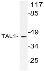 Staining U-2 OS and U-251 MG cells using BDNF Antibody Cat.-No PP1000P